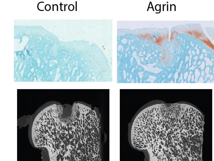 Regeneration: The defective sheep's knee on the right was filled with a gel containing agrin and has regrown cartilage, visible in orange, while the one on the left received no agrin and has no cartilage. Below, CT scans also show better bone regrowth in the agrin-treated knee, right