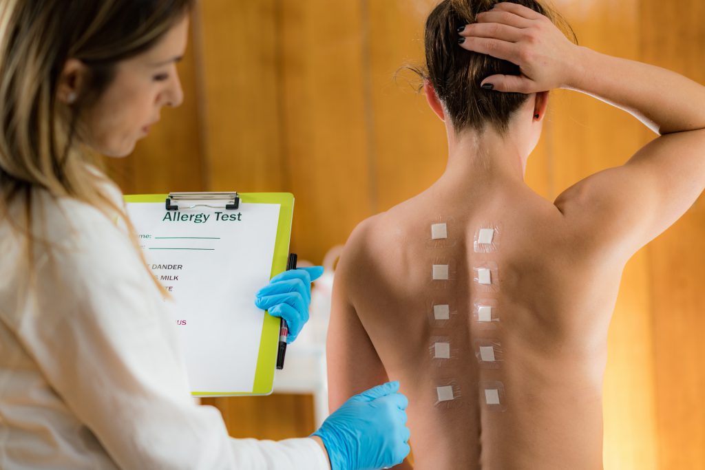 Doctor Doing a Skin Allergy Test - don't ignore your allergy symptoms