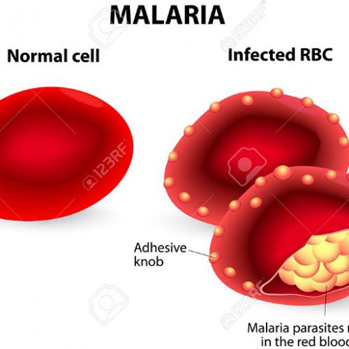 3 African countries trying out 1st malaria vaccine in babies