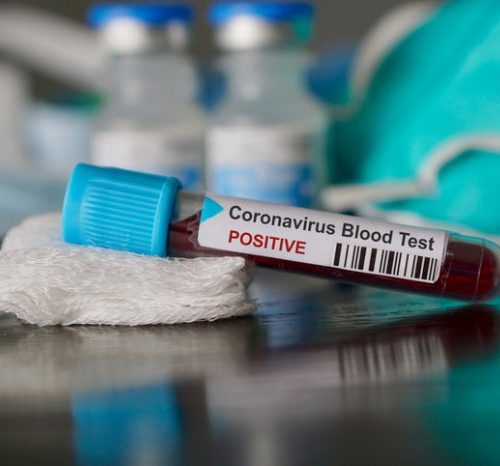 Virus expands grip in many areas, as US nears 100,000 deaths