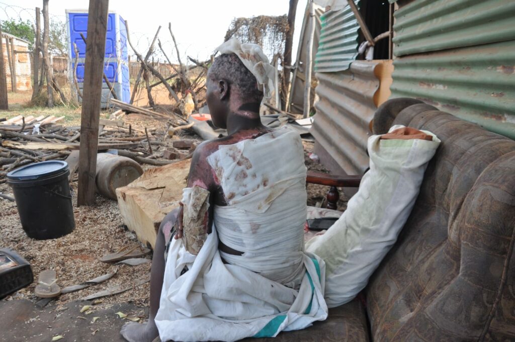 Informal miners burnt to death during police raid: Families demand justice