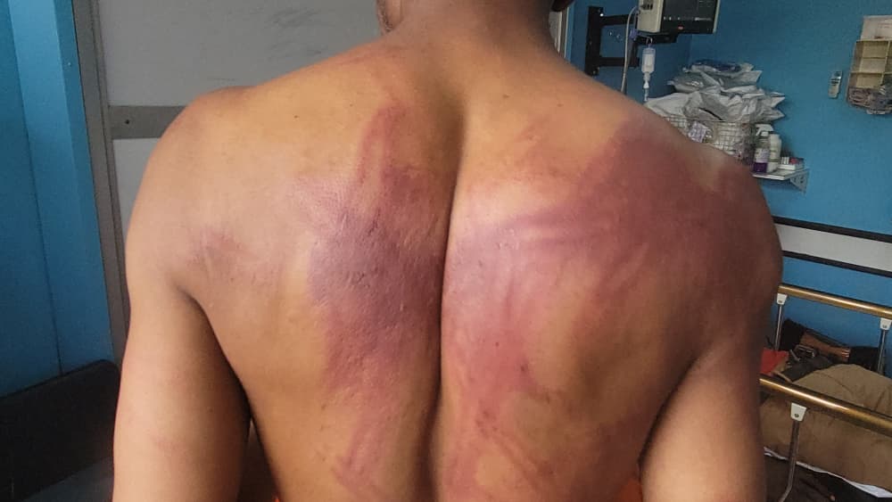 Human rights violations surge as 3 000 victims affected in February only