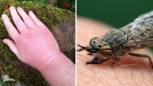 What to do if you’ve been bitten by a horsefly as they descend on Manchester in the heat