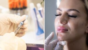 Botox-style injections and lip filler banned for under-18s in England
