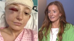 Woman with undiagnosed brain tumour had to visit doctors nine times to get scan