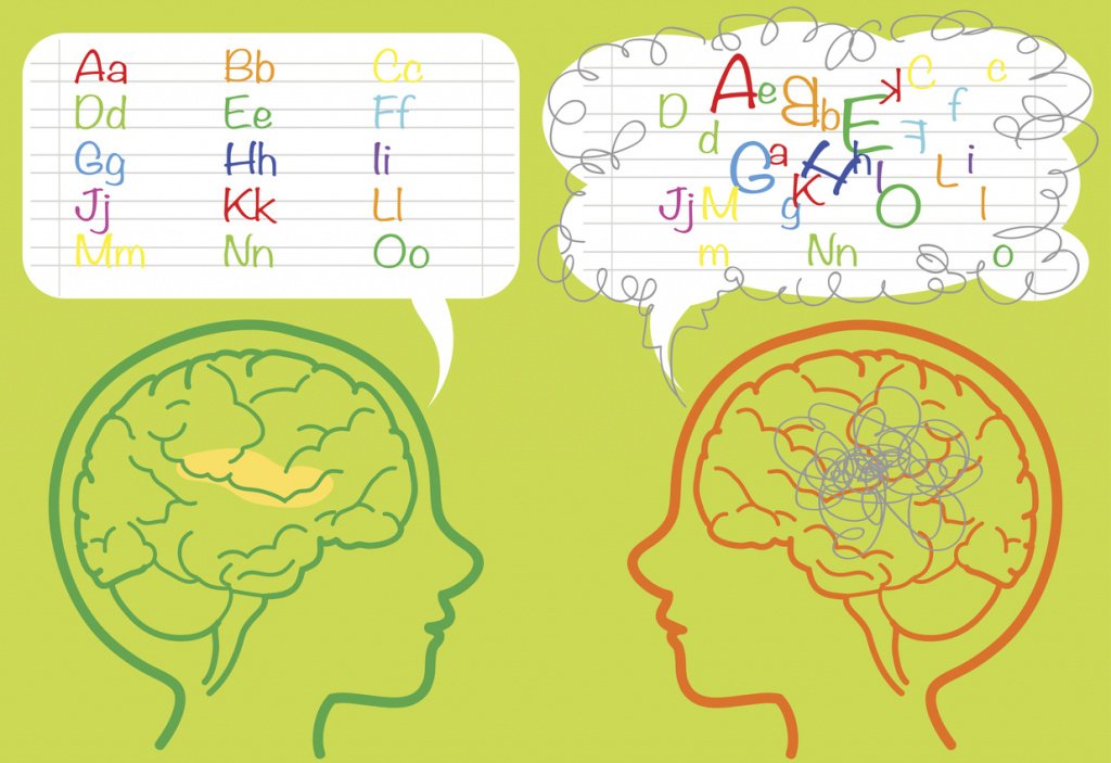 Think like dyslexics